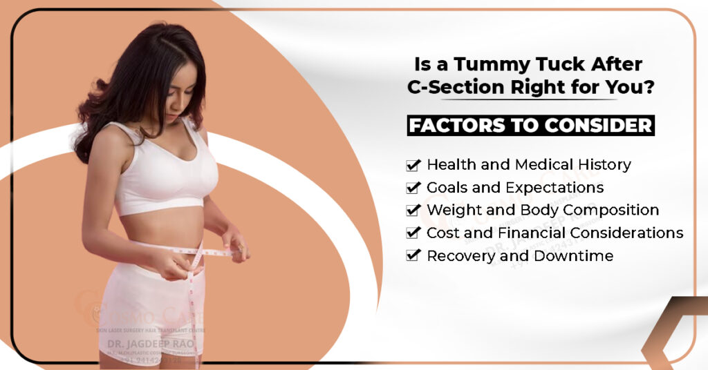 Tummy Tuck After C-Section