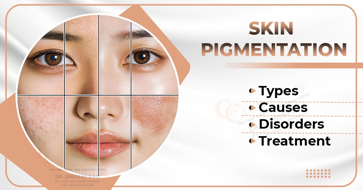 Skin Pigmentation: Types, Causes, Disorders & Treatment