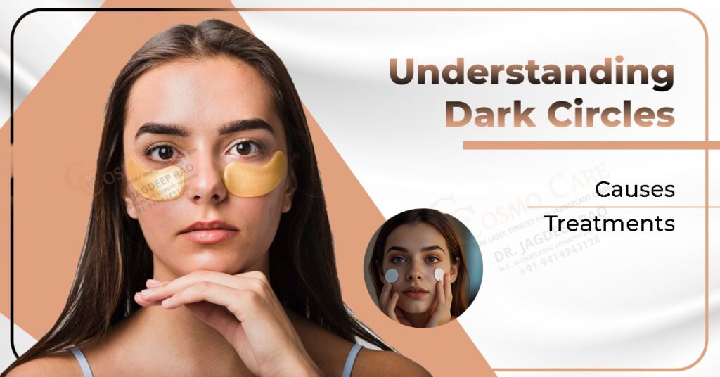 Understanding Dark Circles: Causes and Treatments